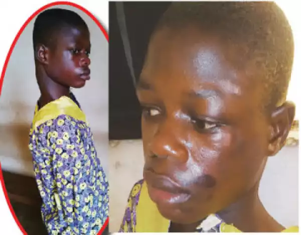 Tortured Boy: Mother Goes Into Hiding As Lagos Govt. Vows To Prosecute Father [See Photo]